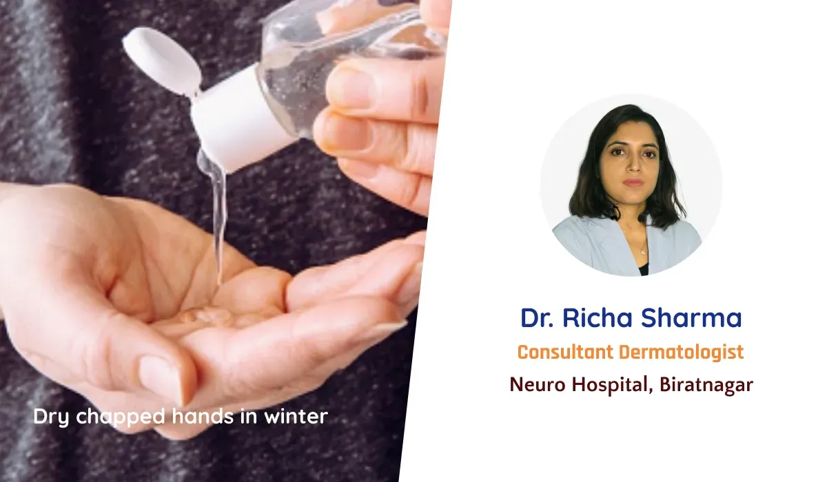 Dry chapped hands in Winter